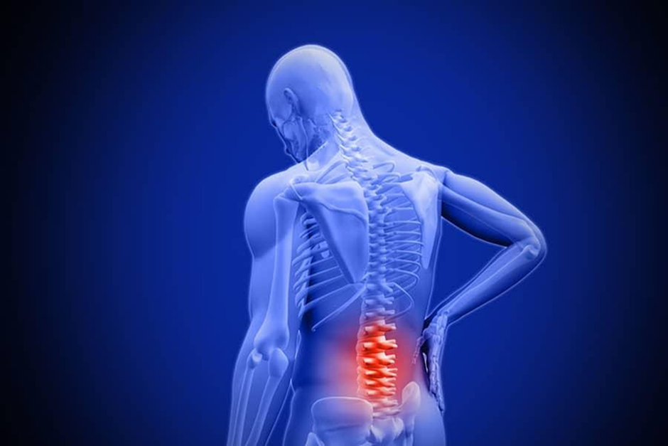 Relieve Low Back Pain with Effective Treatment | Sforzo Dillingham