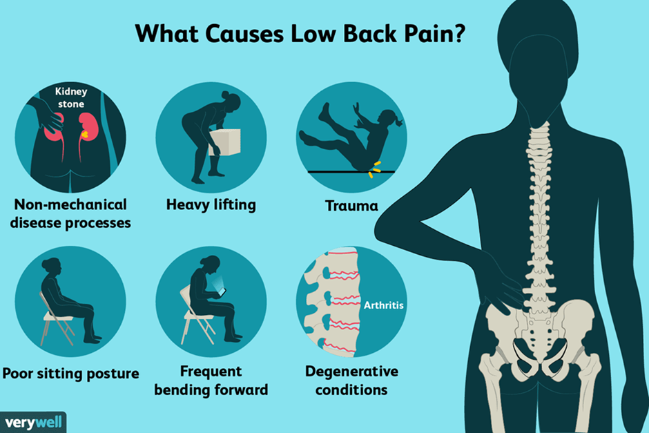 causes-of-low-back-pain