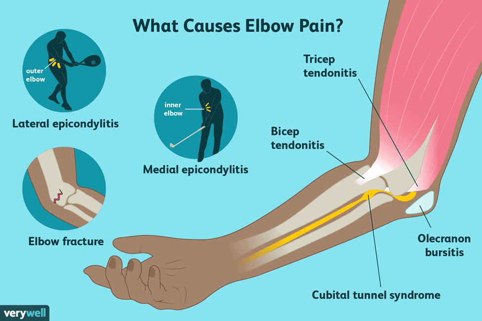 different-causes-of-elbow-pain