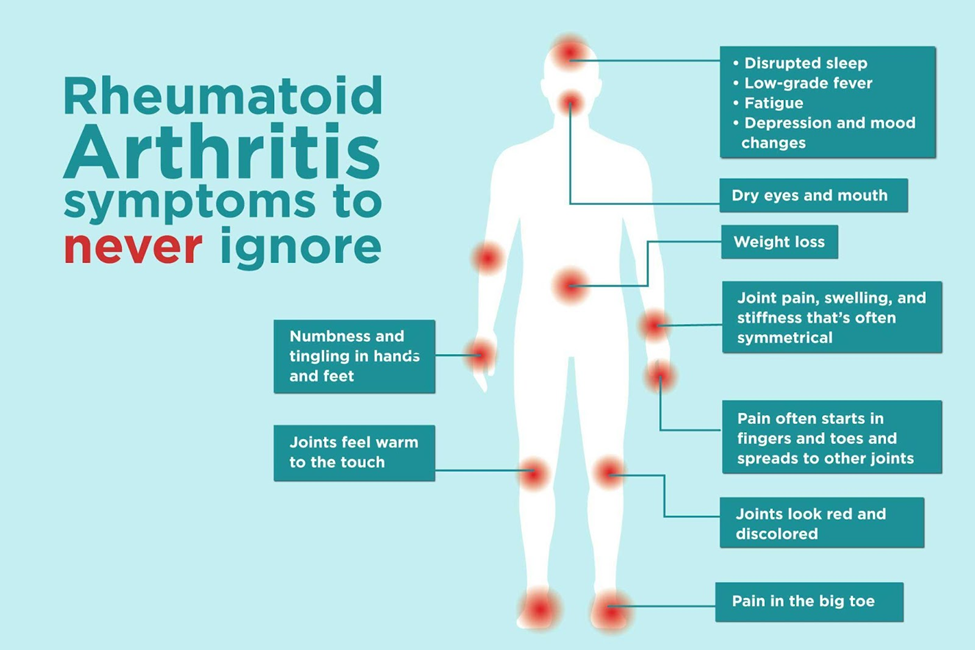 rheumatoid-arthritis-symptoms-to-not-ignore