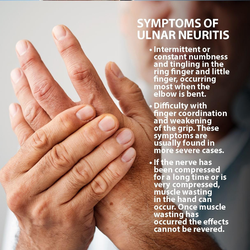 symptoms-of-ulnar-nerve-compression