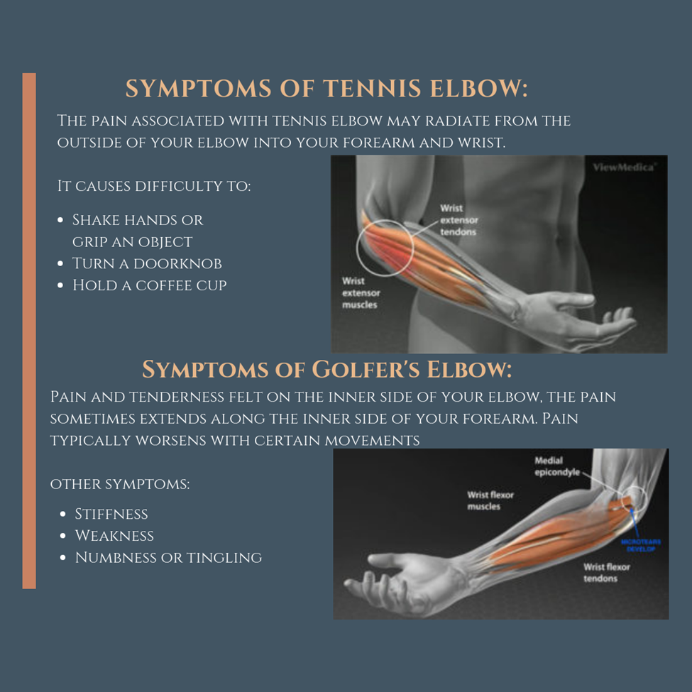 Pil Nøjagtig prøve Tennis Elbow Prevention and Treatment | Sforzo Dillingham