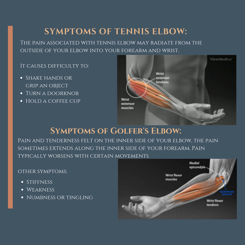 Tennis elbow hotsell