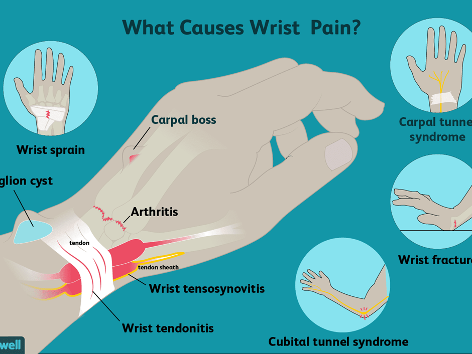 different-causes-of-wrist-pain