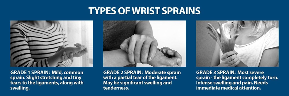 types-of-wrist-sprains