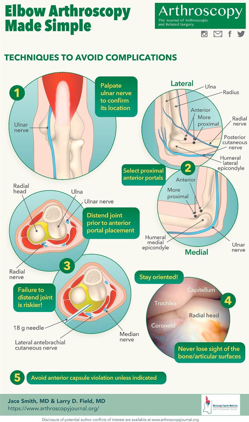 different-techniques-of-elbow-arthroscopy