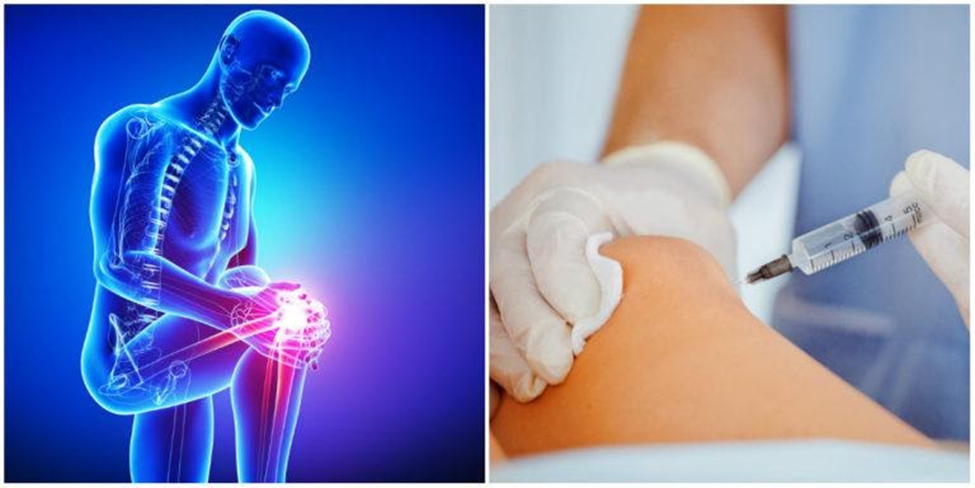 biologic-treatment-for-knee-&-leg-pain