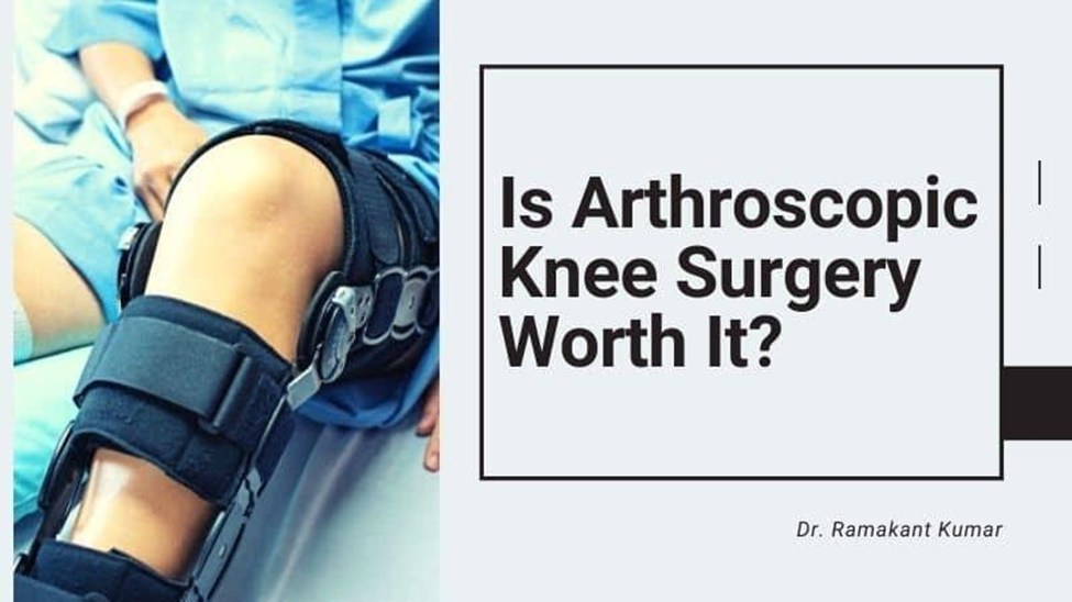 benefits-of-arthroscopic-knee-surgery