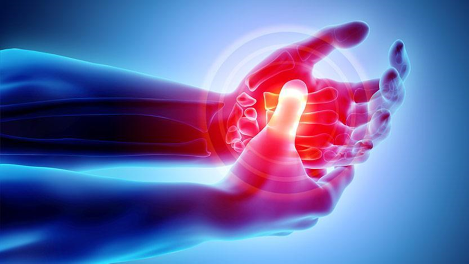 arthritis-diagnosis-of-hand-sforzo