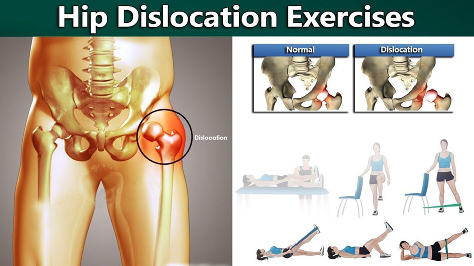 hip-dislocation-exercises