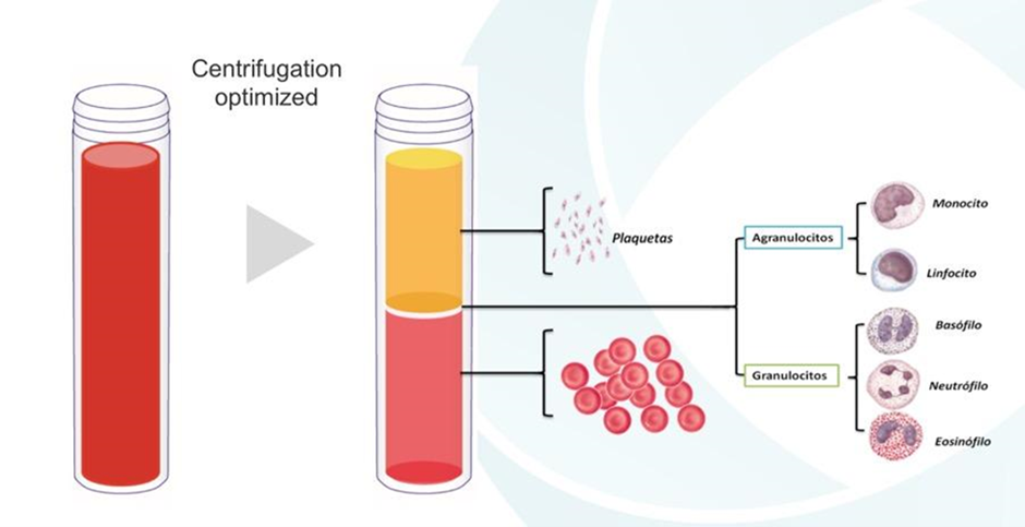 prp-treatment-process