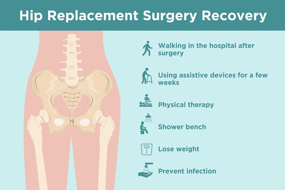 hip-replacement-surgery-recovery