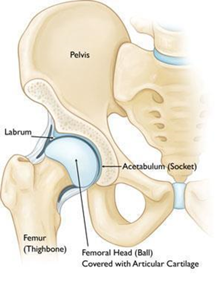 how-hip-dislocation-happens