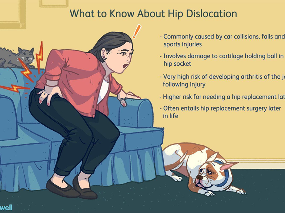 causes-and-symptoms-of-hip-dislocation