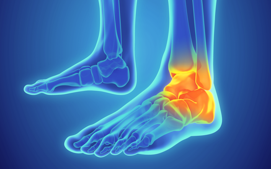 ankle-pain-3d-animated-image