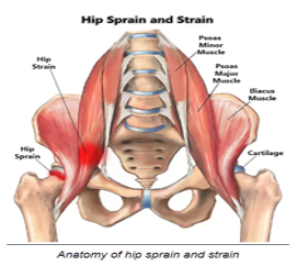 Hip Strains 